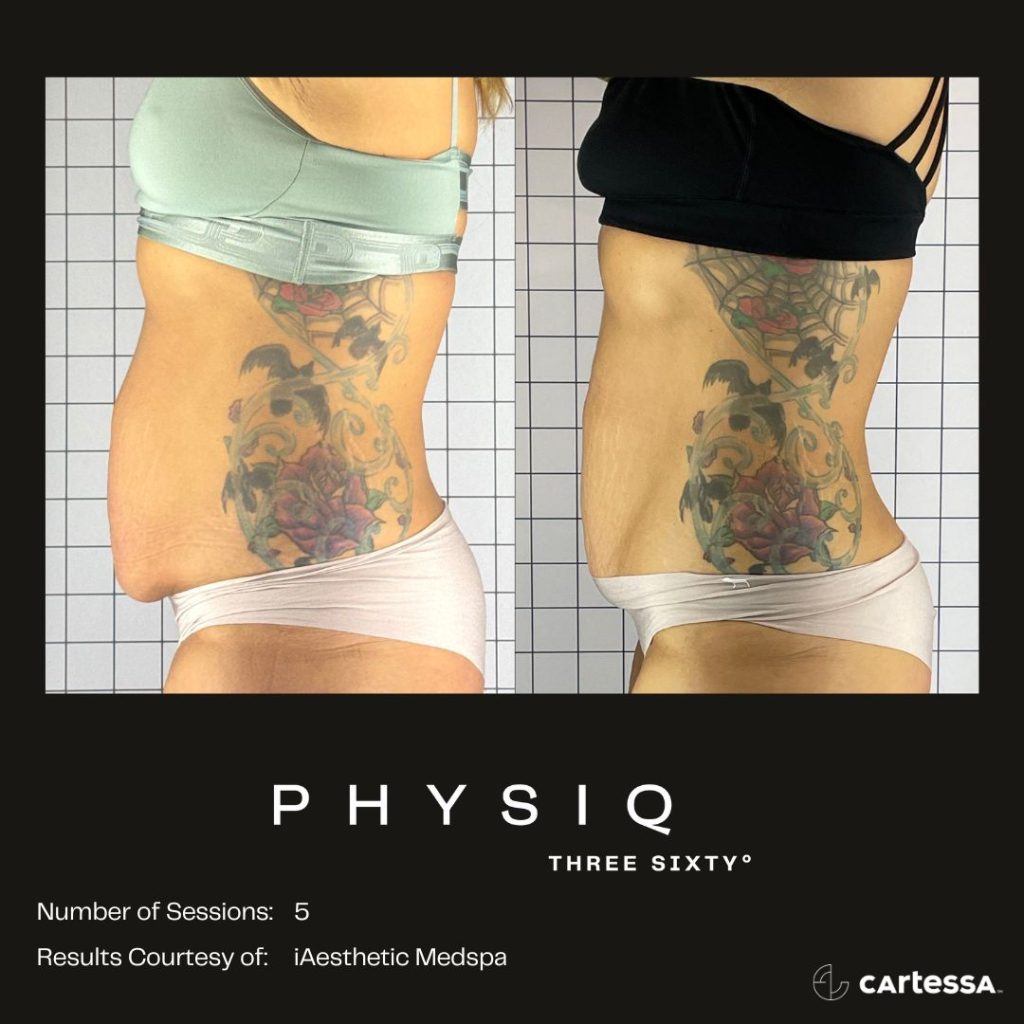 Physiq 360 Before & After