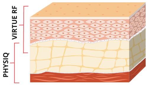 RF diagram on skin